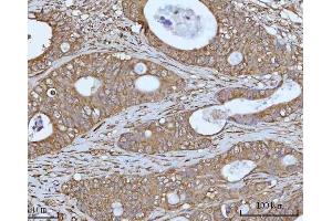 IHC analysis of OCRL using anti-OCRL antibody (ABIN7599572).