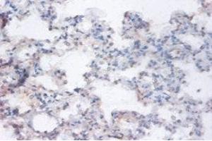 Immunohistochemistry of paraffin-embedded human lung tissue using ABIN7167205 at dilution of 1:100 (RRAGA 抗体  (AA 1-247))