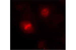 Image no. 1 for anti-Histone H3.1 (HIST1H3B) (Ser10) antibody (ABIN197332) (Histone H3.1 抗体  (Ser10))