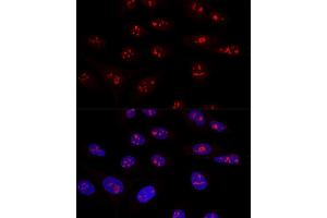 Confocal immunofluorescence analysis of U2OS cells using NOP58 Polyclonal Antibody  at dilution of 1:100. (NOP58 抗体  (AA 360-529))