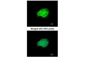 ICC/IF Image Immunofluorescence analysis of paraformaldehyde-fixed A431, using HSPA6, antibody at 1:200 dilution. (HSPA6 抗体  (Center))