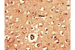 Immunohistochemistry of paraffin-embedded human brain tissue using ABIN7143348 at dilution of 1:100 (Adenylate Kinase 5 抗体  (AA 61-215))
