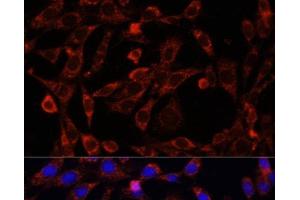Immunofluorescence analysis of NIH/3T3 cells using UCP3 Polyclonal Antibody at dilution of 1:100. (UCP3 抗体)