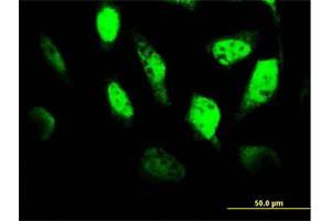 Immunofluorescence of monoclonal antibody to TCF4 on HeLa cell.
