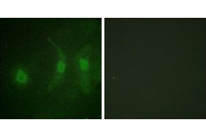 P-peptide - +Immunofluorescence analysis of HeLa cells, using IRF-3 (Phospho-Ser385) antibody. (IRF3 抗体  (pSer385))