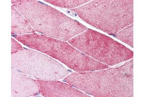 Anti-CAV3 / Caveolin 3 antibody IHC of human skeletal muscle. (Caveolin 3 抗体  (N-Term))