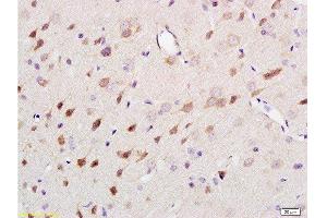 Immunohistochemistry (Paraffin-embedded Sections) (IHC (p)) image for anti-Neurofilament, Heavy Polypeptide (NEFH) (AA 1-100) antibody (ABIN672156)