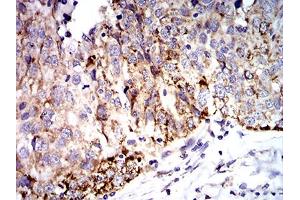 Immunohistochemistry (IHC) image for anti-Superoxide Dismutase 2, Mitochondrial (SOD2) (AA 1-222) antibody (ABIN5888812) (SOD2 抗体  (AA 1-222))