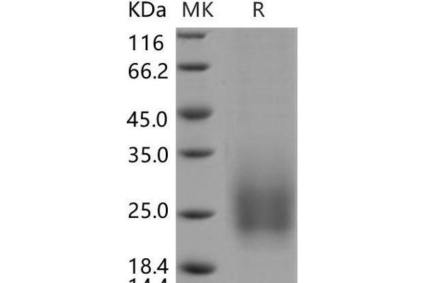 Tetraspanin 7 Protein (TSPAN7) (His tag)