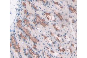 Immunohistochemistry (IHC) image for anti-Collagen, Type VIII, alpha 2 (COL8A2) (AA 533-698) antibody (ABIN1176005)