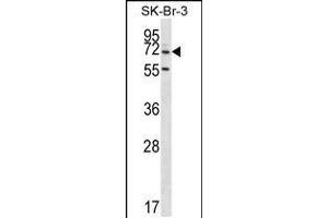 Western blot analysis in SK-BR-3 cell line lysates (35ug/lane). (ZNF398 抗体  (AA 186-215))