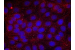 Immunofluorescence staining of methanol-fixed MCF cells using VEGFR2(Phospho-Tyr1214) Antibody. (VEGFR2/CD309 抗体  (pTyr1214))
