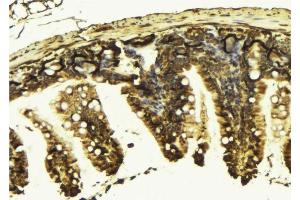 ABIN6277591 at 1/100 staining Mouse colon tissue by IHC-P. (KIF2C 抗体  (C-Term))