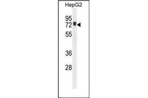 Western blot analysis of LRRC40 Antibody (C-term) in HepG2 cell line lysates (35ug/lane). (LRRC40 抗体  (C-Term))