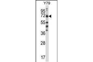 Western blot analysis in Y79 cell line lysates (35ug/lane). (FARSB 抗体  (C-Term))