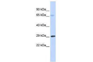 FCER1A antibody used at 1 ug/ml to detect target protein. (Fc epsilon RI/FCER1A 抗体  (Middle Region))