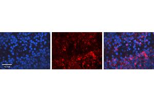 Rabbit Anti-E2F1 Antibody Catalog Number: ARP31171_P050 Formalin Fixed Paraffin Embedded Tissue: Human Lymph Node Tissue Observed Staining: Cytoplasm Primary Antibody Concentration: 1:100 Other Working Concentrations: 1:600 Secondary Antibody: Donkey anti-Rabbit-Cy3 Secondary Antibody Concentration: 1:200 Magnification: 20X Exposure Time: 0. (E2F1 抗体  (Middle Region))