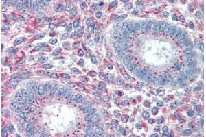 Human Uterus (formalin-fixed, paraffin-embedded) stained with PRRX1 antibody ABIN337108 at 5 ug/ml followed by biotinylated anti-goat IgG secondary antibody ABIN481715, alkaline phosphatase-streptavidin and chromogen. (PRRX1 抗体  (AA 73-83))