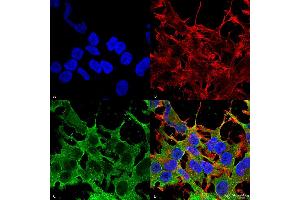 Immunocytochemistry/Immunofluorescence analysis using Mouse Anti-SUR2A Monoclonal Antibody, Clone S319A-14 . (ABCC9 抗体  (AA 1505-1546))