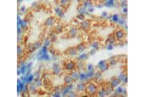 Used in DAB staining on fromalin fixed paraffin-embedded Kidney tissue (PDP 抗体  (AA 315-537))