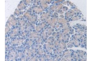 Immunohistochemistry (IHC) image for anti-Hepatocyte Growth Factor (Hepapoietin A, Scatter Factor) (HGF) (AA 306-471) antibody (ABIN7430570)