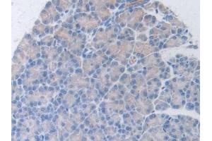 Detection of HGF in Rat Pancreas Tissue using Polyclonal Antibody to Hepatocyte Growth Factor (HGF) (HGF 抗体  (AA 306-471))