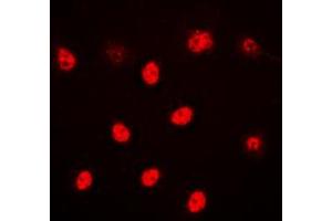 Immunofluorescent analysis of ALX3 staining in HeLa cells. (ALX3 抗体  (Center))