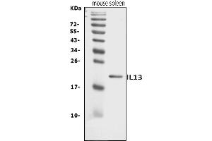 Western blot analysis of Il13 using anti-Il13 antibody (ABIN7600672).