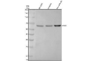 Western blot analysis of PAK3 using anti-PAK3 antibody (ABIN7605846).
