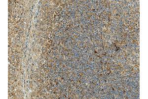 Immunohistochemistry analysis using Rabbit Anti-Rubicon Polyclonal Antibody (ABIN5066353). (Rubicon 抗体  (N-Term))