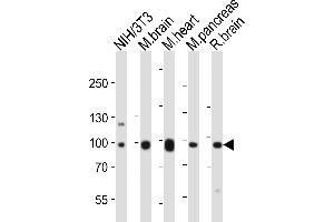 Western blot analysis of lysates from mouse NIH/3T3 cell line, mouse brain, mouse heart, mouse pancreas, rat brain tissue lysate (from left to right), using Ephb1 Antibody (Center) (ABIN6243651 and ABIN6577667). (EPH Receptor B1 抗体  (AA 304-339))