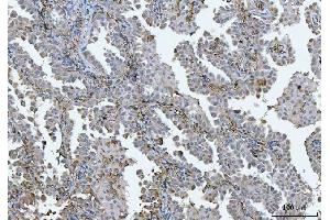 IHC analysis of BI-1/TMBIM6 using anti-BI-1/TMBIM6 antibody (ABIN7603199). (Bax Inhibitor 1 抗体  (N-Term))
