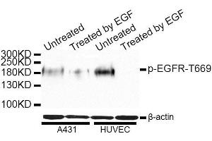 Western blot analysis of extracts of A-431 and HUVEC cells, using Phospho-EGFR-T669 antibody. (EGFR 抗体  (pThr669))