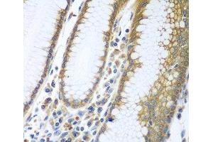 Immunohistochemistry of paraffin-embedded Human stomach using FUT6 Polyclonal Antibody at dilution of 1:100 (40x lens). (FUT6 抗体)