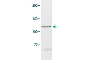 The cell lysate derived from MCF-7 was immunoprobed by PGR polyclonal antibody  at 1 : 500. (Progesterone Receptor 抗体  (C-Term))