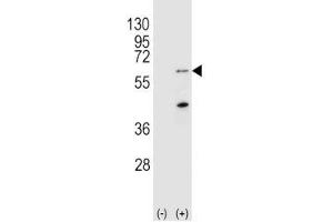 Western blot analysis of PINK1 antibody and 293 cell lysate (2 ug/lane) either nontransfected (Lane 1) or transiently transfected (2) with the Park6/PINK1 gene. (PINK1 抗体  (AA 118-147))