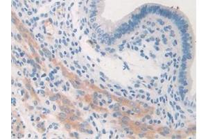 Immunohistochemistry (IHC) image for anti-Collagen, Type II, alpha 1 (COL2A1) (AA 1307-1383) antibody (ABIN7438682)