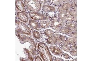Immunohistochemical staining of human stomach with NLRP14 polyclonal antibody  shows moderate cytoplasmic positivity in glandular cells. (NLRP14 抗体)