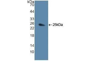 Detection of Recombinant JAG1, Human using Polyclonal Antibody to Jagged 1 (JAG1) (JAG1 抗体  (AA 836-1047))