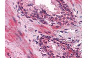 Immunohistochemical analysis of paraffin-embedded human Prostate tissues using LCN1 mouse mAb (Lipocalin 1 抗体)
