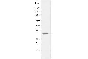 Western blot analysis of extracts from COLO205 cells using APEX1 antibody. (APEX1 抗体  (N-Term))