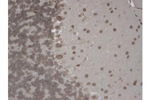 IHC analysis of TrpM7 tested on mouse brain using a dilution of TRPM7 antibody. (TRPM7 抗体  (AA 1817-1863) (PE))