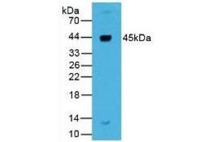 Detection of REN in Human Liver Tissue using Polyclonal Antibody to Renin (REN) (Renin 抗体  (AA 67-153))