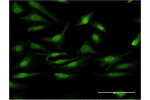 Immunofluorescence of monoclonal antibody to PRKCD on HeLa cell. (PKC delta 抗体  (AA 577-676))