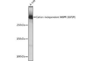 Western blot analysis of extracts of A-549 cells, using Cation-independent Cation-independent M6PR (IGF2R) (IGF2R) Rabbit mAb (ABIN1678848, ABIN3018066, ABIN3018067 and ABIN7101574) at 1:1000 dilution. (IGF2R 抗体)