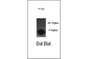 Dot blot analysis of anti-Phospho-cJun-S63 Antibody (ABIN389545 and ABIN2839590) on nitrocellulose membrane. (C-JUN 抗体  (pSer63))