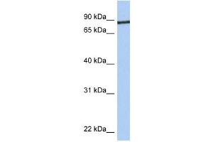 Junctophilin 1 antibody used at 1 ug/ml to detect target protein.