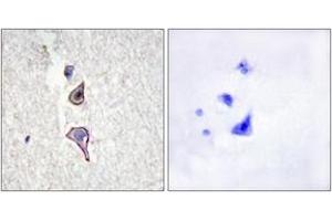 Immunohistochemistry (IHC) image for anti-Mannose Receptor, C Type 2 (MRC2) (AA 121-170) antibody (ABIN1534165)