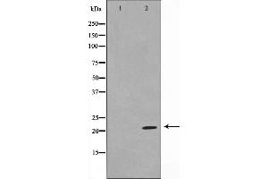 Western blot analysis on Jurkat cell lysate using TPD54 Antibody，The lane on the left is treated with the antigen-specific peptide. (TPD52L2 抗体  (C-Term))