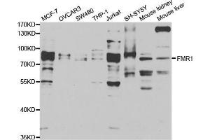 Western blot analysis of extracts of various cell lines, using FMR1 antibody (ABIN5973291) at 1/1000 dilution. (FMR1 抗体)